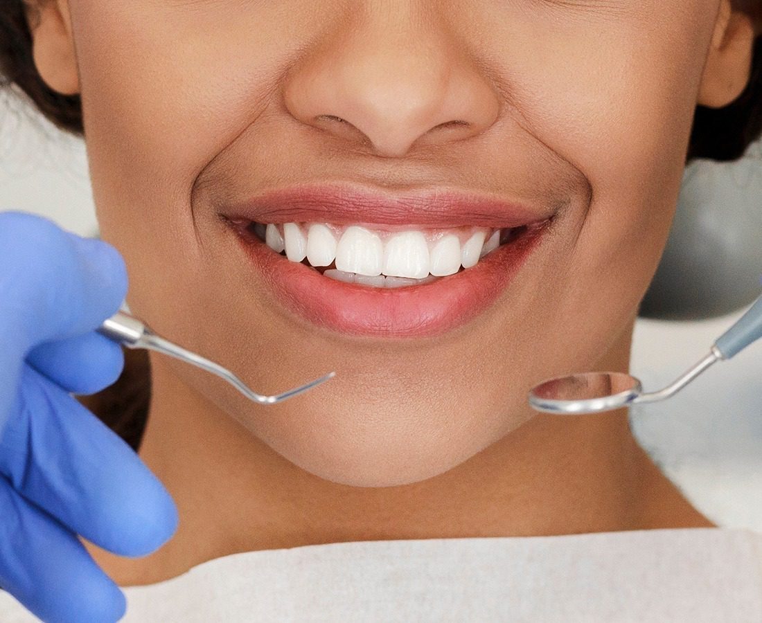 Close-up of a woman smiling during a dental exam, with a dentist‚Äôs gloved hands holding dental tools near her mouth.